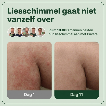 Zeepzakje